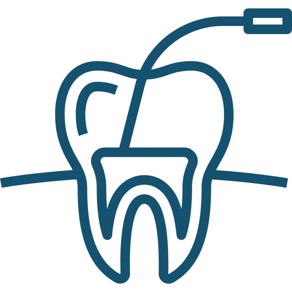 Devitalizzazione dente a Borgomanero